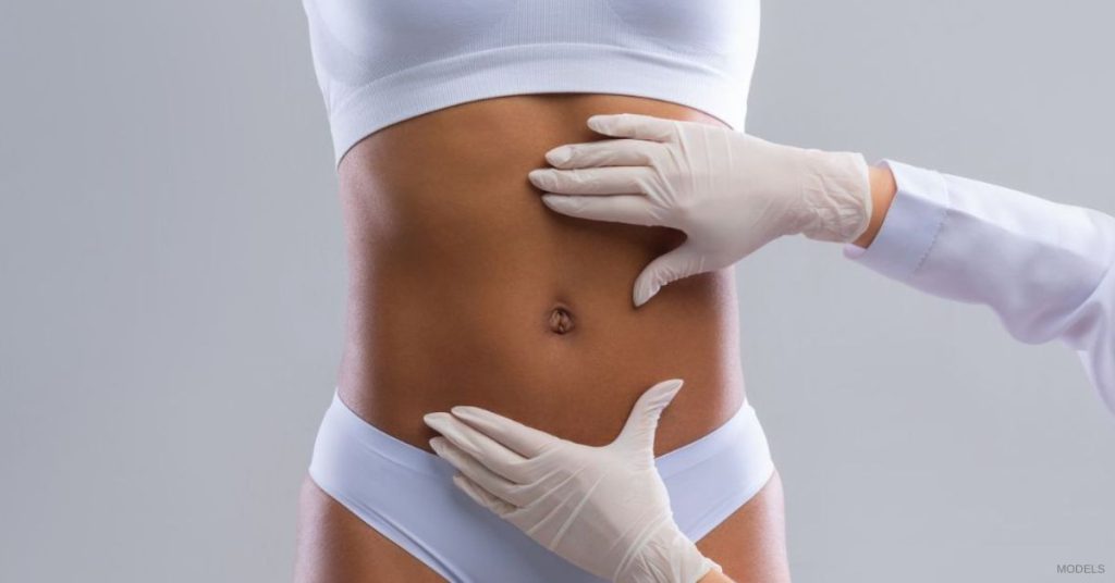 Doctor gently examining a woman's abdomen (MODELS) post full-body lift surgery.